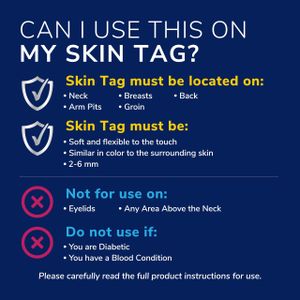 Scholl Skin Tag Removal Kit – Easy At-Home Remover