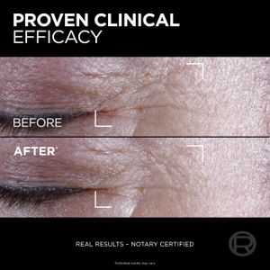 L'Oréal Paris Age Perfect Midnight Eye Cream – Antioxidant, 15ml