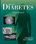 ATLAS OF DIABETES,3/E