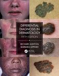 Differential Diagnosis in Dermatolo