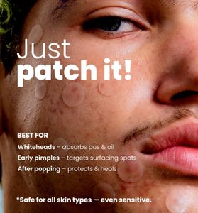 ROSELYNBOUTIQUE Pimple Patches, 300 Count – Acne Spot Treatment