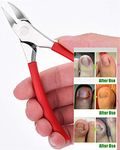 Toenail Clippers for Thick or Ingrown Toenails - YEESAM Precision Eagle Mouth Long Handle Toe Nail Clippers Scissors for Seniors Professional Trimmer, Hard Toe Nail Fingernail Strong Big Nail Nippers