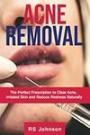 Acne Removal: The Perfect Prescript