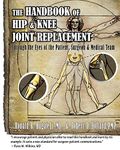 Knee Joint Replacement