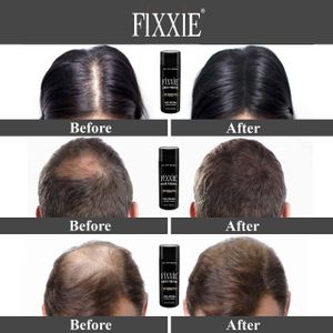 FIXXIE Hair Fibres Medium Brown 27.5g – Instant Thicker Hair