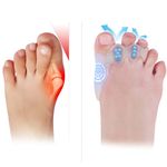 Bunion For Kids