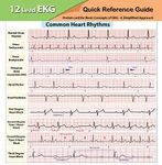 EKG Pocket Card