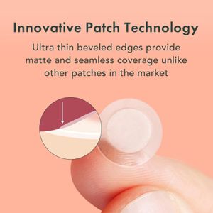 Rael Pimple Patches 96-Pack – Hydrocolloid Acne Spot Treatment
