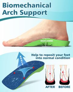 QBK Arch Support Insoles, Small – Orthotic Shoe Inserts for Comfort