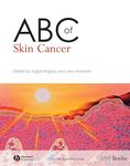 ABC of Skin Cancer (ABC Series)