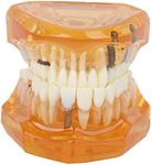 Dpofirs 1pc Orange Color Dental Disease Removable Study Teaching Teeth Model, Dental Model for Dental Schools Programs, Dental Implant Model Adult Teeth Gums Standard Demonstration Tool