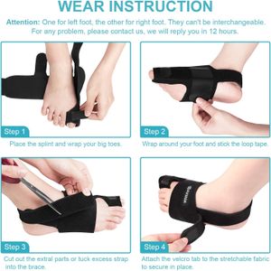 AVIDDA Bunion Corrector Set – Adjustable Splints & Gel Toe Separators, Black