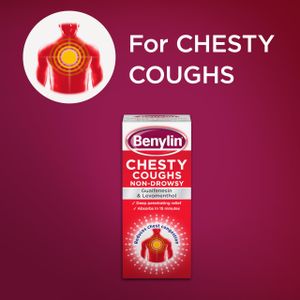 Benylin Chesty Cough Syrup, 300ml – Fast Relief Formula