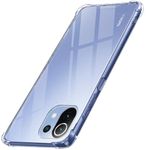TheGiftKart ShockProof Clear Back Cover Case for Xiaomi Mi 11 Lite NE 5G / Mi 11 Lite | 360 Degree Protection | Hard Transparent Back Case for Mi 11 Lite / 11 Lite NE 5G (PC & TPU, Transparent Bumper)