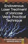 Endovenous Laser Treatment of Varic