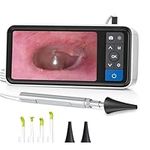 Digital Otoscope Ear Camera HD Visu