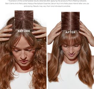 Kérastase Symbiose Moisturising Anti-Dandruff Shampoo, Sulphate-Free, 250ml