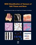 WHO Classification of Tumours of Soft Tissue and Bone: WHO Classification of Tumours, Volume 5 (World Health Organization classification of tumours)