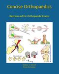 Concise Orthopaedic Notes: Revision aid for FRCS , EBOT , SICOT and Board Examinations (Concise Orthopaedics)