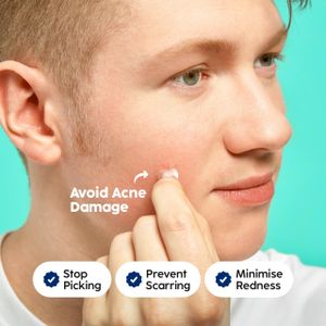 Patch Perfect Hydrocolloid Pimple Patches, 102 Count – Acne Spot Treatment