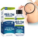 Skin Tag Remover, Mole Remover,Wart Remover,Easy Use at Home 1.0 fl oz (30ml)