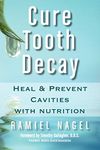 Cure Tooth Decay: Heal & Prevent Cavities with Nutrition