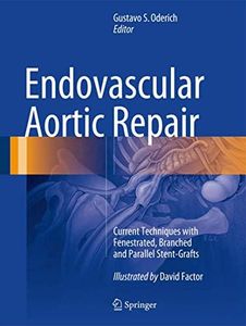 Endovascular Aortic Repair: Current Techniques with Fenestrated, Branched and Parallel Stent-Grafts