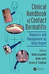 Clinical Handbook of Contact Dermat