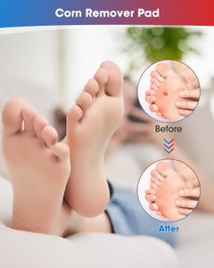 MYMULIKE Corn Removal Pads, 60 Count – Foot Callus Treatment