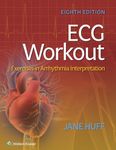 ECG Workout: Exercises in Arrhythmia Interpretation