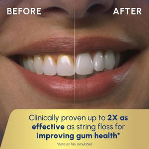 Waterpik ION Cordless Water Flosser – Rechargeable Dental Cleaner