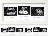 Sonogram Picture Frame - Trio Ultra