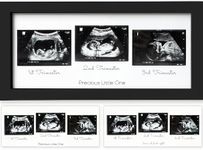 Sonogram P