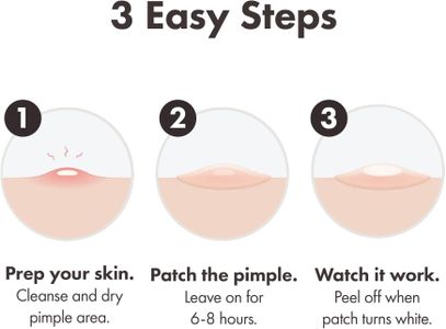 Mighty Patch Original Acne Patches – Blemish Spot Treatment Strips