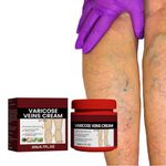 Leg Cream For Varicose Veins