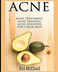 Acne: Acne Treatment: Acne Removal: