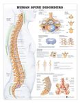 The Human Spine Disorders Anatomical