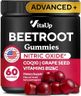 VitaUp Beet Root Gummies – Nitric Oxide Beets Supplements – with CoQ10, Grape Seed, Vitamin C, B12 & B3 – 60 Beets Chews