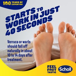 Scholl Verruca & Wart Freeze Remover Kit, 80ml – Effective Treatment, 1 Pack