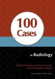 100 Cases in Radiology: 9