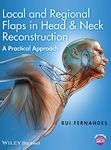 Local and Regional Flaps in Head and Neck Reconstruction: A Practical Approach