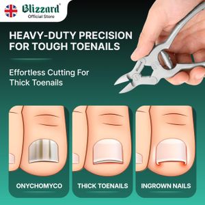 Blizzard Professional Toenail Clippers – Heavy Duty Stainless Steel, 15cm with Metal File