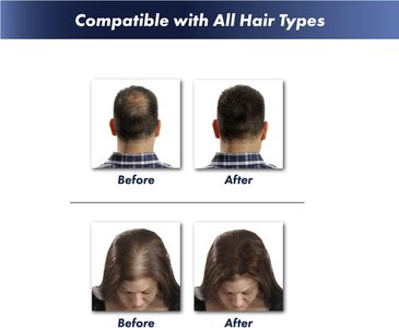 KeraFiber Hair Fibres Dark Brown – Instant Thicker Hair