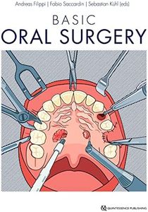 Basic Oral Surgery