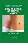 How To Get Rid Of Stretch Marks: Learn the 12 Powerful Scientifically Proven Natural And Artificial Remedies To Stretch Marks Including The Suitable Workouts