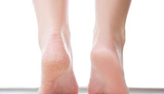 Ever Ready Corn and Callus Remover Kit – Foot Care Solution