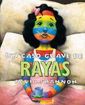 Un caso grave de rayas (A Bad Case of Stripes): (Spanish language edition of A Bad Case of Stripes)