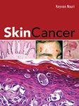 Skin Cancer (DERMATOLOGY)