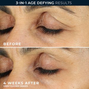 RoC Retinol Eye Cream 15ml – Anti-Aging Eye Treatment