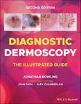 Diagnostic Dermoscopy: The Illustrated Guide